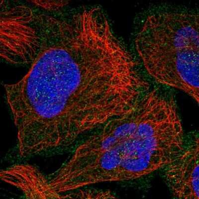 Immunocytochemistry/ Immunofluorescence: RAB23 Antibody [NBP1-86367]