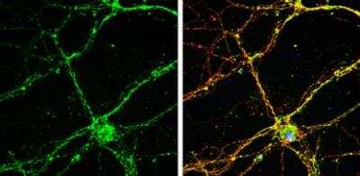 Immunocytochemistry/ Immunofluorescence: RAB26 Antibody [NBP2-20040]