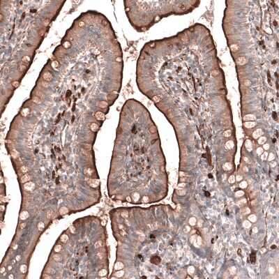 Immunohistochemistry-Paraffin: RAB27B Antibody [NBP1-89538]