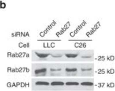 Western Blot: RAB27B Antibody [NBP1-79631]