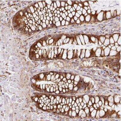 Immunohistochemistry: RAB30 Antibody [NBP2-30410]