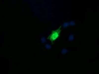 Immunocytochemistry/ Immunofluorescence: RAB30 Antibody (OTI3E7) - Azide and BSA Free [NBP2-73771]