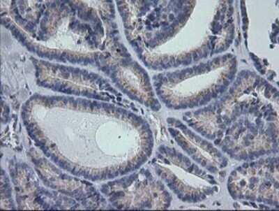 Immunohistochemistry: RAB30 Antibody (OTI3E7) - Azide and BSA Free [NBP2-73771]