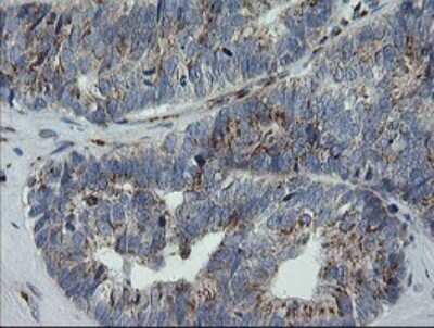 Immunohistochemistry: RAB30 Antibody (OTI3E7) [NBP2-45498]