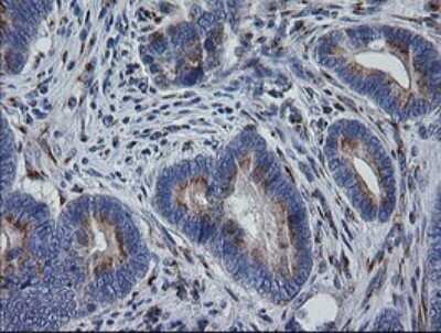 Immunohistochemistry: RAB30 Antibody (OTI3E7) [NBP2-45498]
