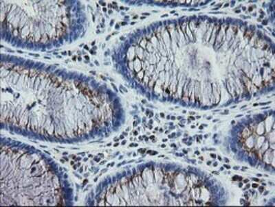 Immunohistochemistry: RAB30 Antibody (OTI3E7) [NBP2-45498]