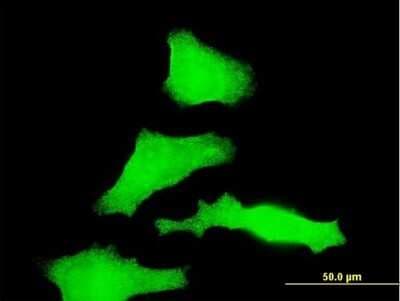 Immunocytochemistry/ Immunofluorescence: RAB31 Antibody (4D12) [H00011031-M03]