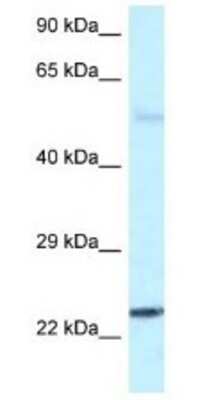 Western Blot: RAB31 Antibody [NBP1-79921]