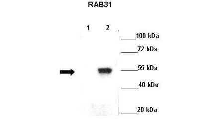 Western Blot: RAB31 Antibody [NBP1-79921]