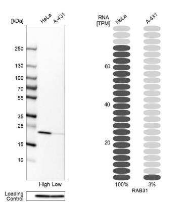Western Blot: RAB31 Antibody [NBP1-80859]