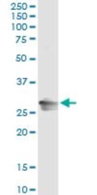 Immunoprecipitation: RAB32 Antibody (1C7) [H00010981-M01]