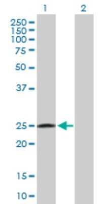 Western Blot: RAB32 Antibody [H00010981-D01P]