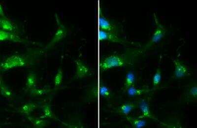 Immunocytochemistry/ Immunofluorescence: RAB35 Antibody [NBP2-20042]