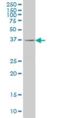 Western Blot: RAB36 Antibody (6A6) [H00009609-M01]
