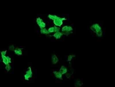 Immunocytochemistry/ Immunofluorescence: RAB37 Antibody (OTI2F1) - Azide and BSA Free [NBP2-73772]