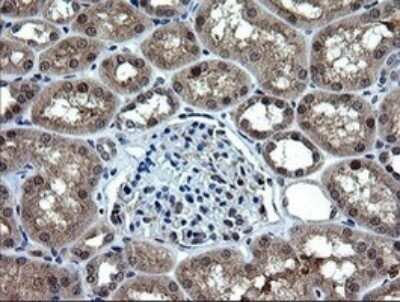Immunohistochemistry: RAB37 Antibody (OTI2F1) - Azide and BSA Free [NBP2-73772]