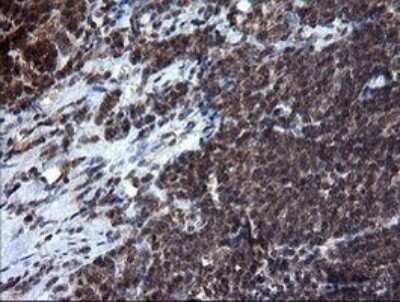 Immunohistochemistry: RAB37 Antibody (OTI2F1) - Azide and BSA Free [NBP2-73772]