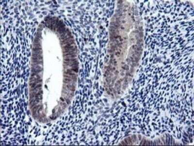 Immunohistochemistry: RAB37 Antibody (OTI2F1) [NBP2-45926]