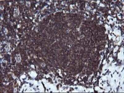 Immunohistochemistry: RAB37 Antibody (OTI2F1) [NBP2-45926]