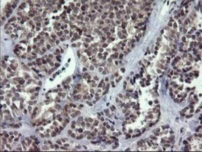 Immunohistochemistry: RAB37 Antibody (OTI2F1) [NBP2-45926]