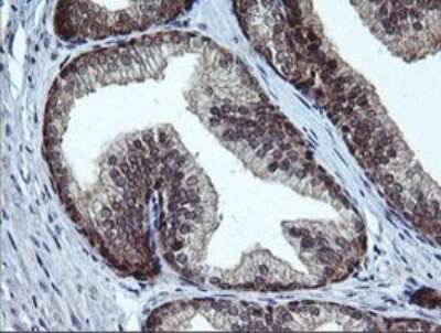 Immunohistochemistry: RAB37 Antibody (OTI2F1) [NBP2-45926]