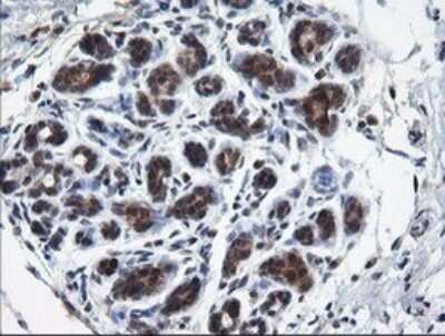 Immunohistochemistry: RAB37 Antibody (OTI2F1) [NBP2-45926]