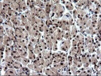 Immunohistochemistry: RAB37 Antibody (OTI2F1) [NBP2-45926]