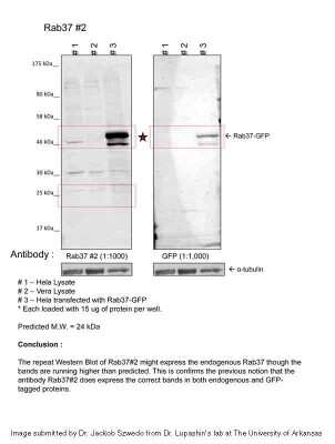 Western Blot: RAB37 Antibody [NBP2-82325]