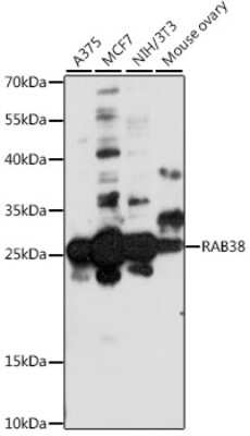 Western Blot: RAB38 AntibodyAzide and BSA Free [NBP2-94562]