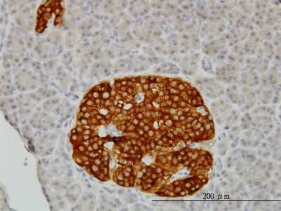 Immunohistochemistry-Paraffin: RAB3B Antibody (3F12) [H00005865-M01]