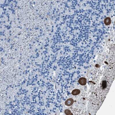 Immunohistochemistry-Paraffin: RAB3IL1 Antibody [NBP1-86245]