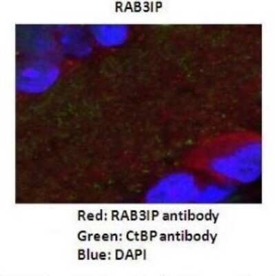 Immunohistochemistry: RAB3IP Antibody [NBP1-56744]