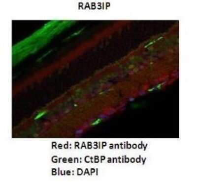 Immunohistochemistry: RAB3IP Antibody [NBP1-56744]