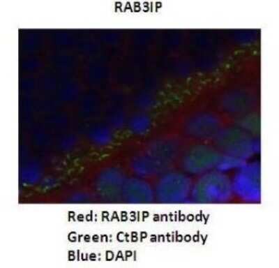 Immunohistochemistry: RAB3IP Antibody [NBP1-56744]