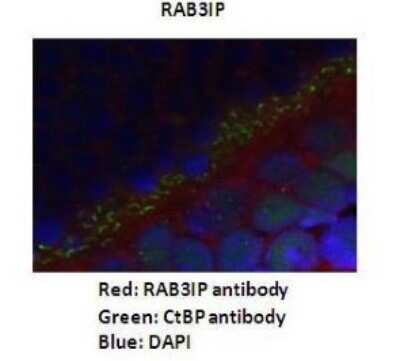 Immunohistochemistry: RAB3IP Antibody [NBP1-56744]