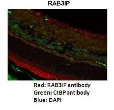 Immunohistochemistry: RAB3IP Antibody [NBP1-56745]