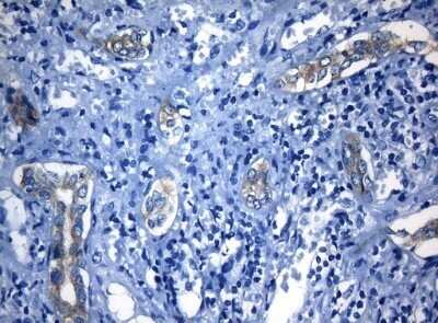 Immunohistochemistry: RAB3IP Antibody (OTI5F2) - Azide and BSA Free [NBP2-73775]