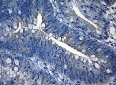 Immunohistochemistry: RAB3IP Antibody (OTI5F2) - Azide and BSA Free [NBP2-73775]