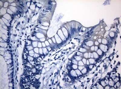 Immunohistochemistry: RAB3IP Antibody (OTI5F2) - Azide and BSA Free [NBP2-73775]