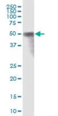 Western Blot: RAB3IP Antibody [H00117177-B01P]