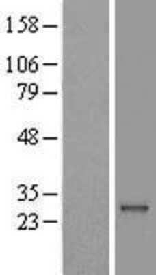 Western Blot: RAB41 Overexpression Lysate [NBL1-15077]