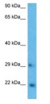 Western Blot: RAB43 Antibody [NBP3-09514]