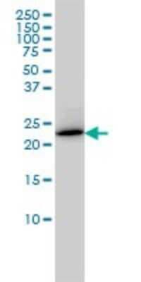 Western Blot: RAB6A Antibody (3G3) [H00005870-M01]