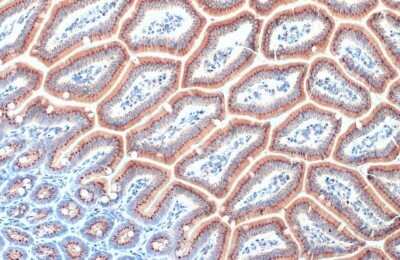 Immunohistochemistry-Paraffin: RAB6A Antibody (HL1047) [NBP3-13701]