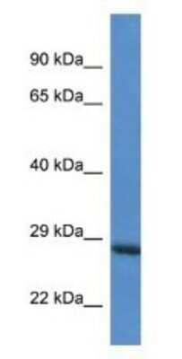 Western Blot: RAB6C Antibody [NBP1-74265]