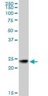 Western Blot: RAB7B Antibody (3B3) [H00338382-M01]