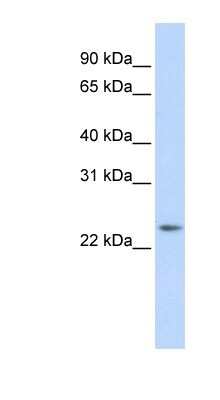 Western Blot: RAB8A Antibody [NBP1-79960]