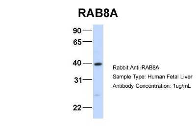 Western Blot: RAB8A Antibody [NBP1-79960]