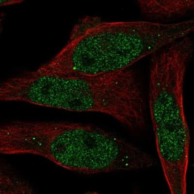 Immunocytochemistry/ Immunofluorescence: RAB8B Antibody [NBP2-57641]