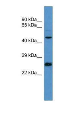 Western Blot: RAB8B Antibody [NBP1-68974]